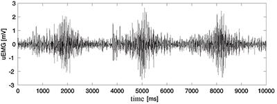 Critical Appraisal of Surface Electromyography (sEMG) as a Taught Subject and Clinical Tool in Medicine and Kinesiology